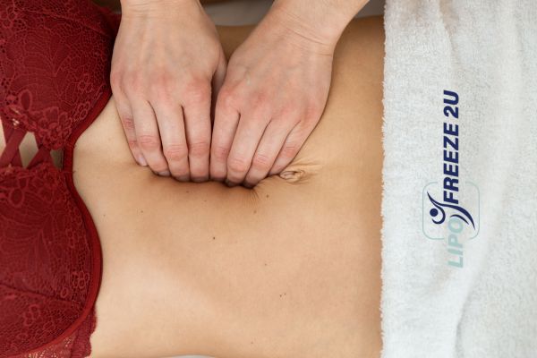 diastasis recti treatment Shoreditch