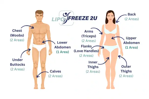 Areas you can have fat freezing treatment Shoreditch
