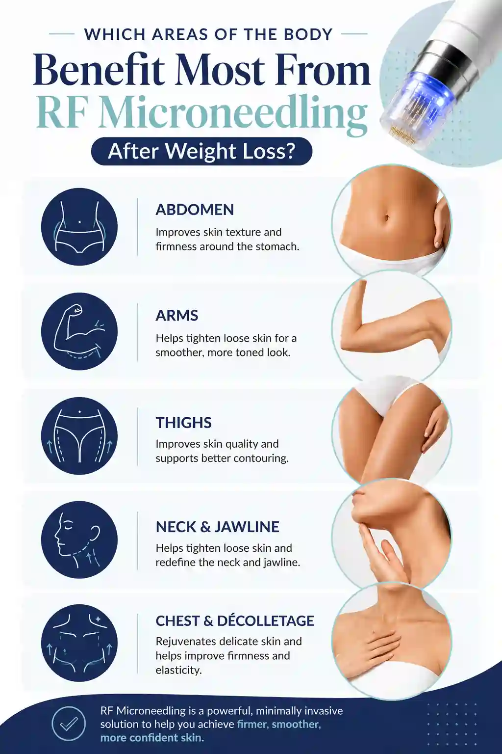 Which Areas of the Body Benefit Most From RF Microneedling After Weight Loss Shoreditch